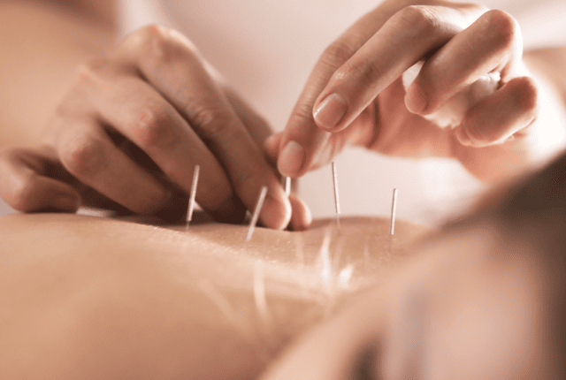 Acupuncture Treatment Dubai | Traditional Chinese Medicine Dubai